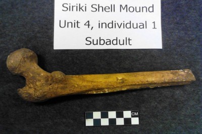 Figure 6. Sub-adult femur of individual 1.